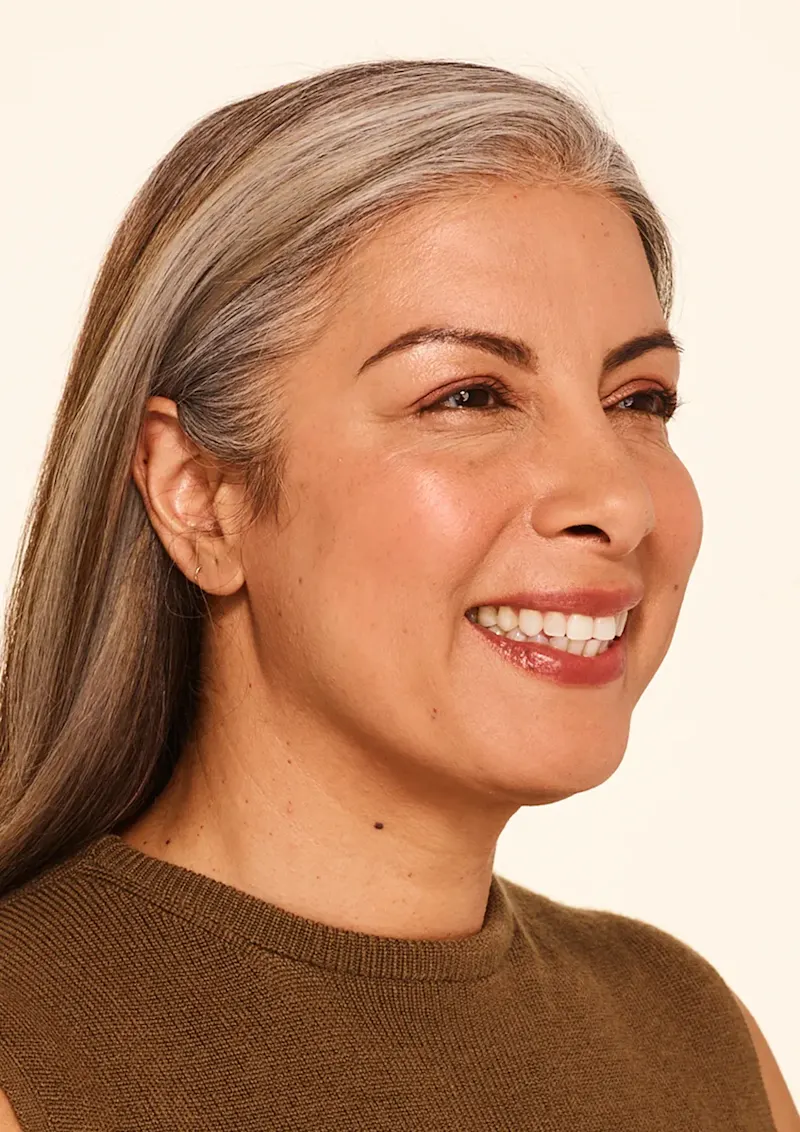Delfina after Botox treatment