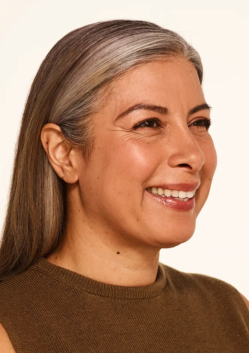 Delfina before Botox treatment