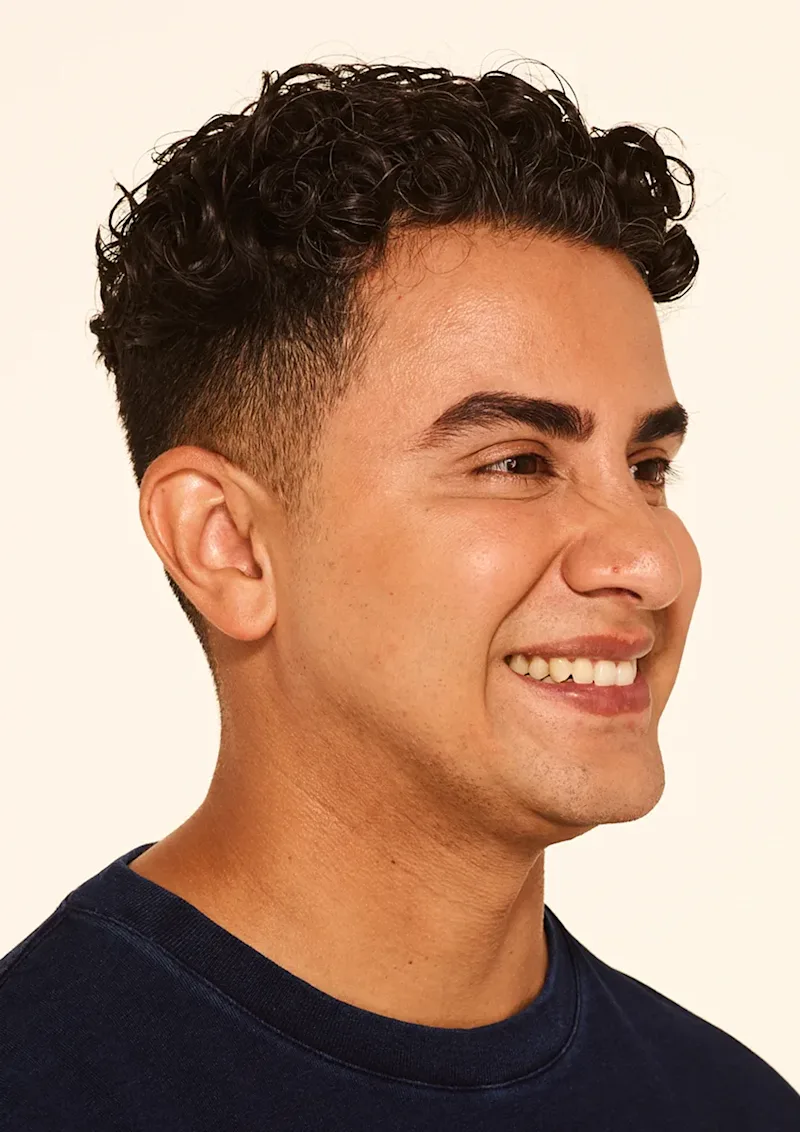 Jeffrey after Botox treatment