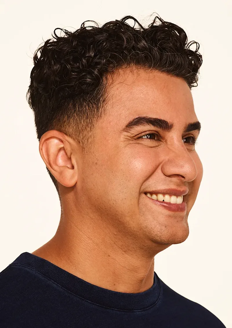 Jeffrey before Botox treatment
