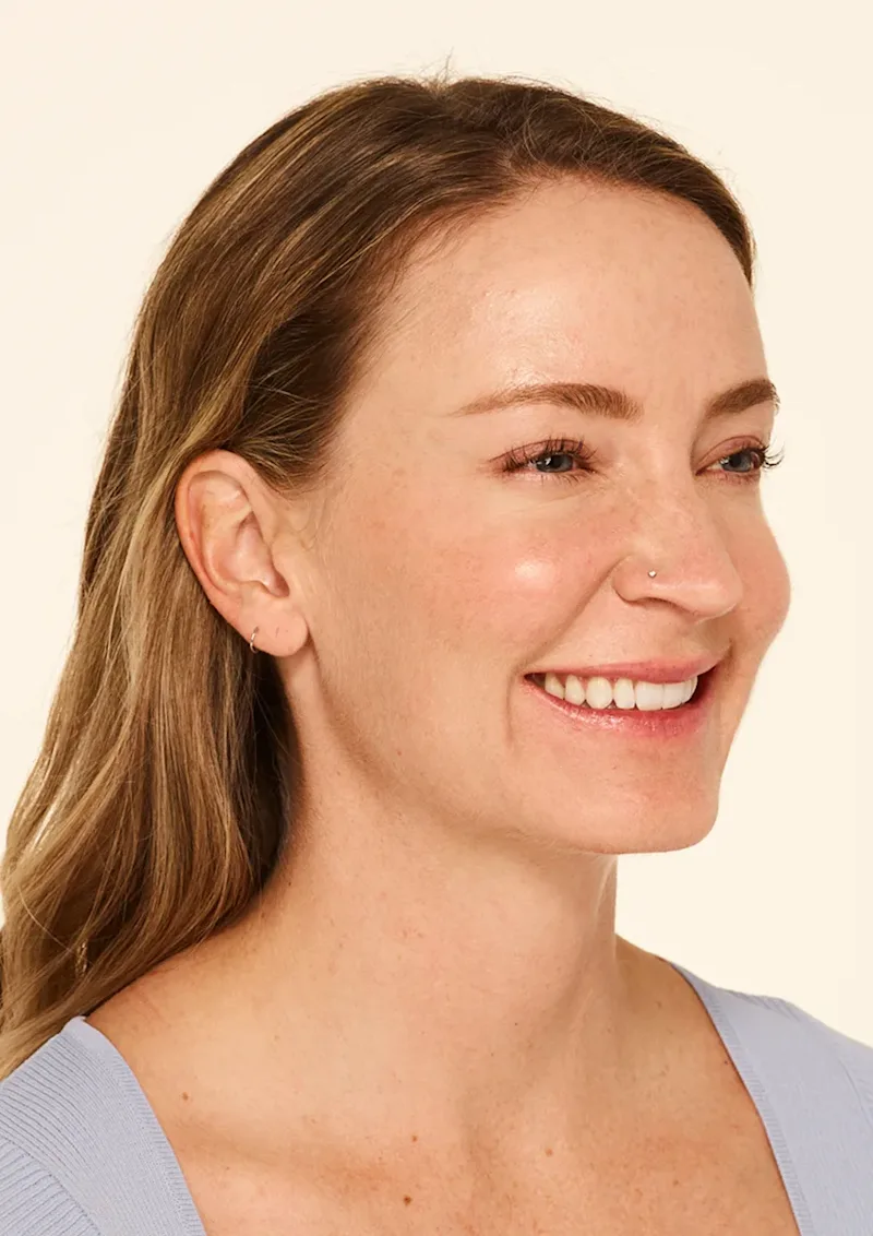 Mandy after Botox treatment