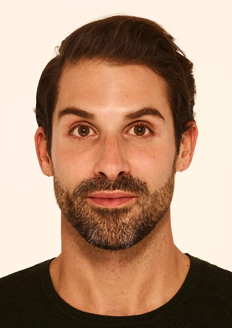 Stephen after Botox treatment